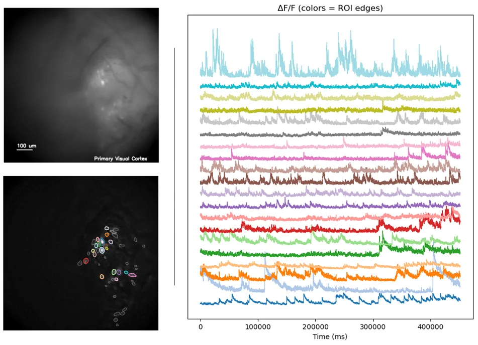 Example calcium imaging data showing ROI extraction and ΔF/F traces